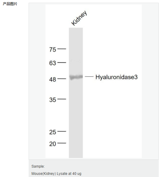 6052b493cc7ad.png image.png