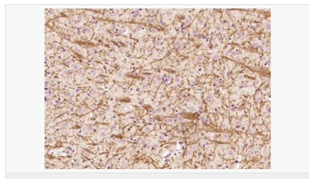 605410274c89a.png image.png