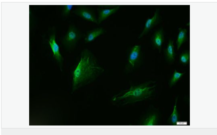 605803e5309ce.png image.png