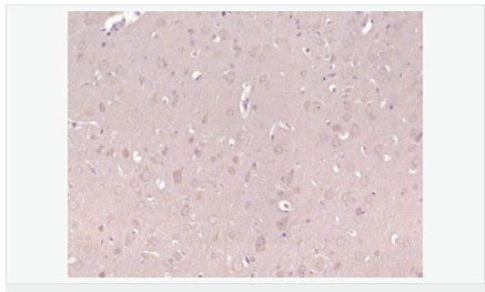 605946900f130.png image.png