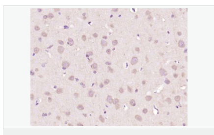 60599758a15b8.png image.png