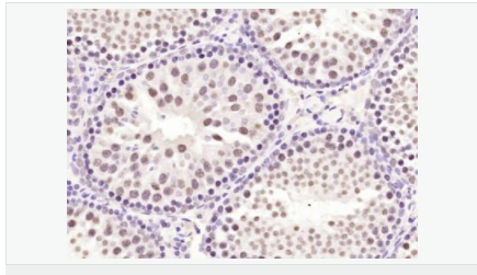 605c40d951701.png image.png