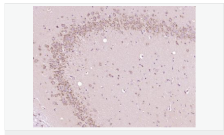 605da1a852bf9.png image.png