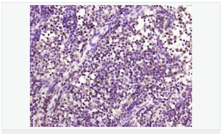 6063d55bacdd5.png image.png