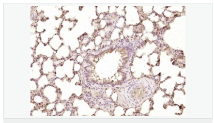 6066b32cbecd1.png image.png