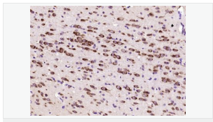 6066c2f36bcc6.png image.png