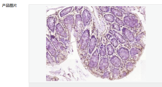 6066d8d16b945.png image.png