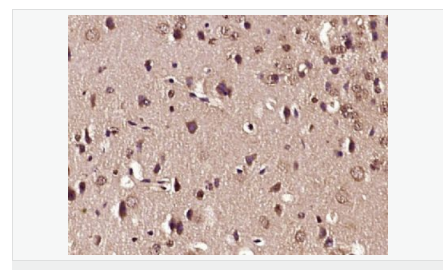 6066da684ab10.png image.png