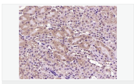 606bc45dde73b.png image.png